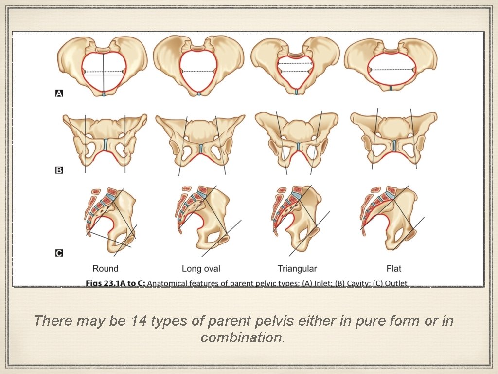 There may be 14 types of parent pelvis either in pure form or in