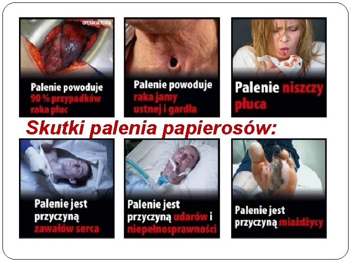 Skutki palenia papierosów: 