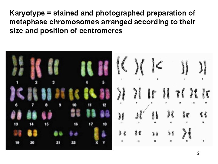 Karyotype = stained and photographed preparation of metaphase chromosomes arranged according to their size