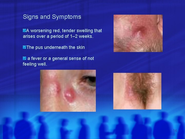 Signs and Symptoms A worsening red, tender swelling that arises over a period of