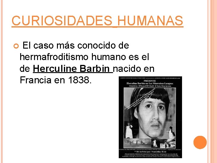 CURIOSIDADES HUMANAS El caso más conocido de hermafroditismo humano es el de Herculine Barbin