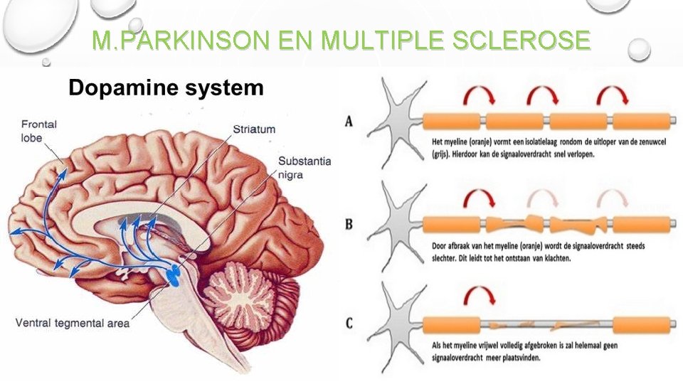 M. PARKINSON EN MULTIPLE SCLEROSE 