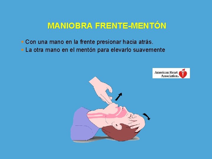 MANIOBRA FRENTE-MENTÓN § Con una mano en la frente presionar hacia atrás. § La