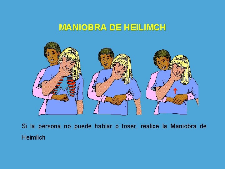 MANIOBRA DE HEILIMCH Si la persona no puede hablar o toser, realice la Maniobra