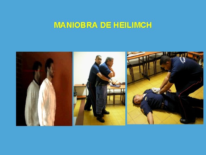 MANIOBRA DE HEILIMCH 