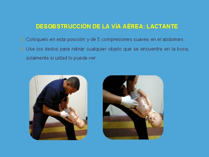 DESOBSTRUCCIÓN DE LA VÍA AÉREA: LACTANTE � Colóquelo en esta posición y dé 5