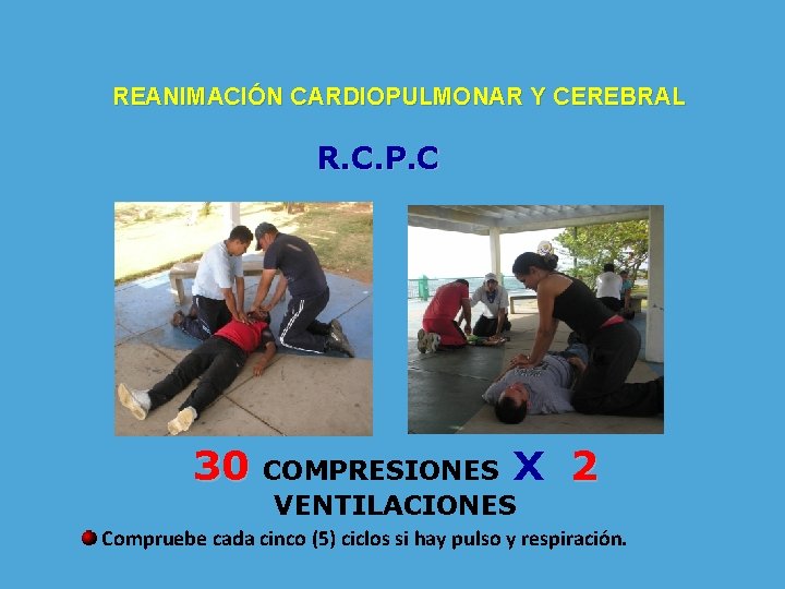 REANIMACIÓN CARDIOPULMONAR Y CEREBRAL R. C. P. C 30 COMPRESIONES X VENTILACIONES 2 Compruebe