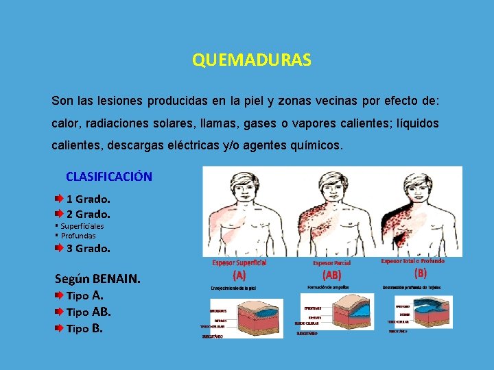 QUEMADURAS Son las lesiones producidas en la piel y zonas vecinas por efecto de: