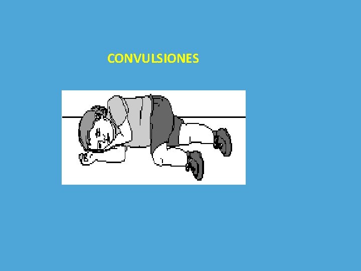 CONVULSIONES 