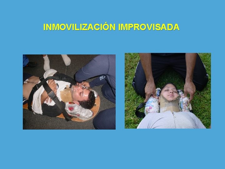 INMOVILIZACIÓN IMPROVISADA 