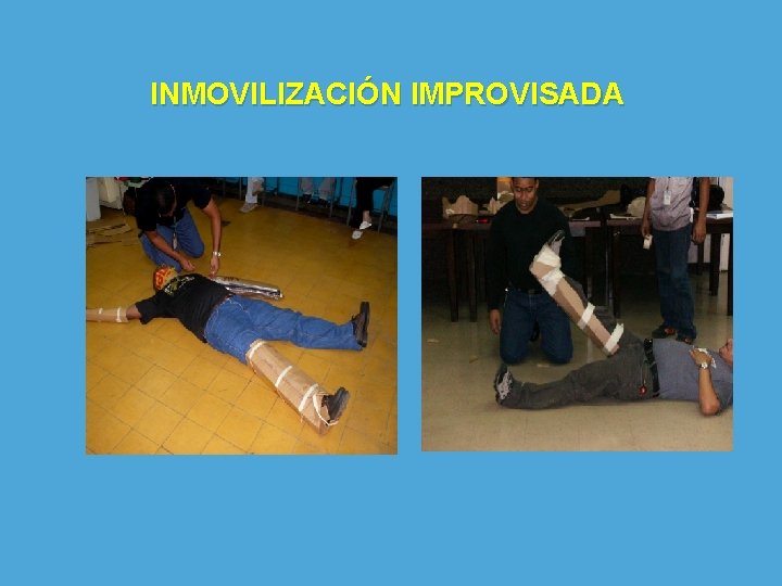 INMOVILIZACIÓN IMPROVISADA 