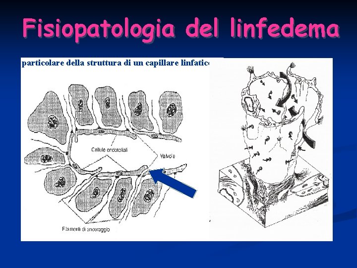 Fisiopatologia del linfedema particolare della struttura di un capillare linfatico 