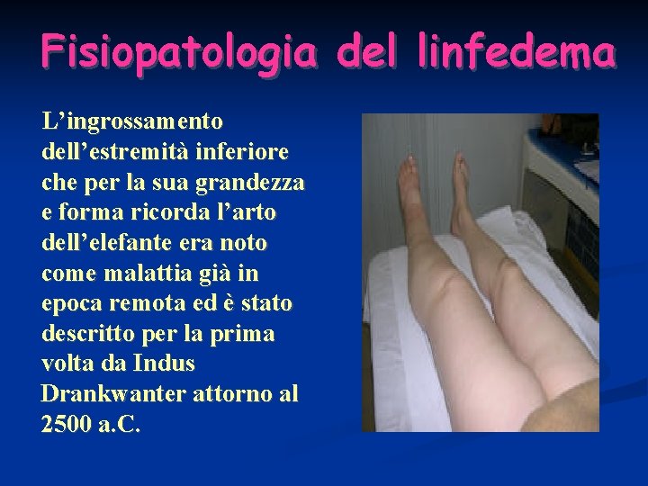 Fisiopatologia del linfedema L’ingrossamento dell’estremità inferiore che per la sua grandezza e forma ricorda