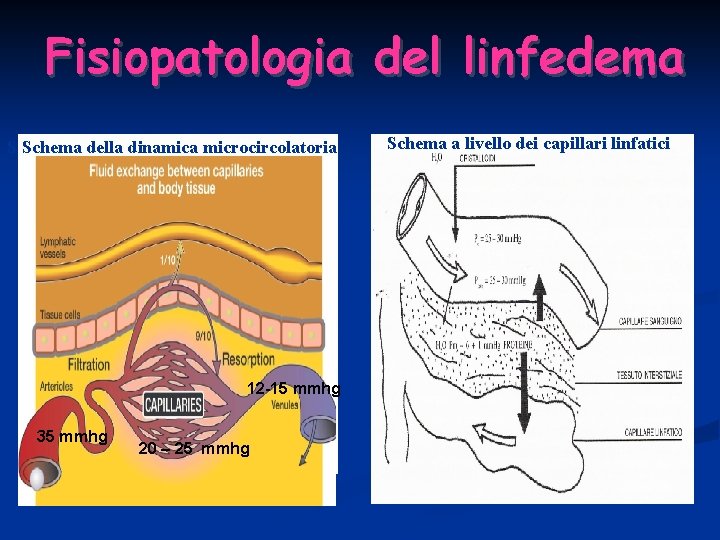 Fisiopatologia del linfedema S Schema della dinamica microcircolatoria 12 -15 mmhg 35 mmhg 20