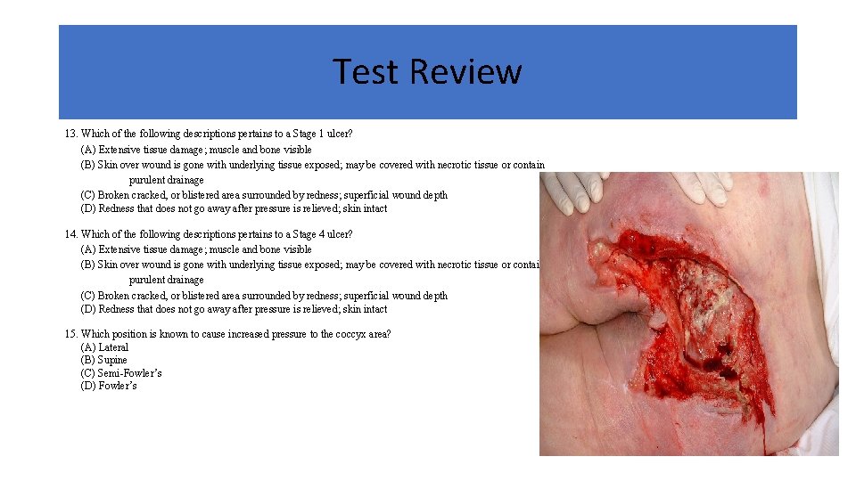 Test Review 13. Which of the following descriptions pertains to a Stage 1 ulcer?