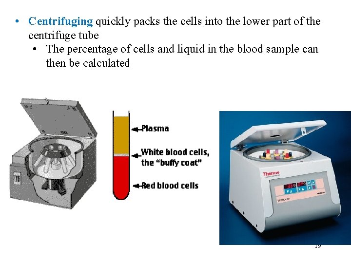  • Centrifuging quickly packs the cells into the lower part of the centrifuge