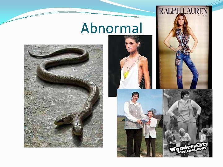 Abnormal 