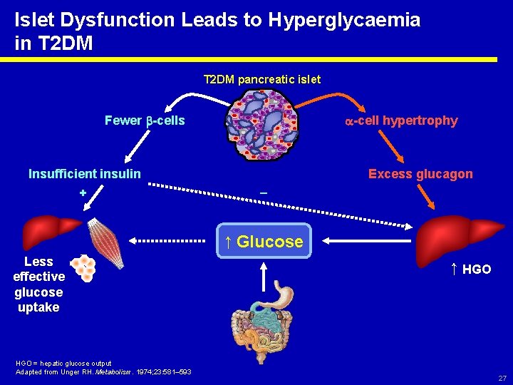 Islet Dysfunction Leads to Hyperglycaemia in T 2 DM pancreatic islet -cell hypertrophy Fewer
