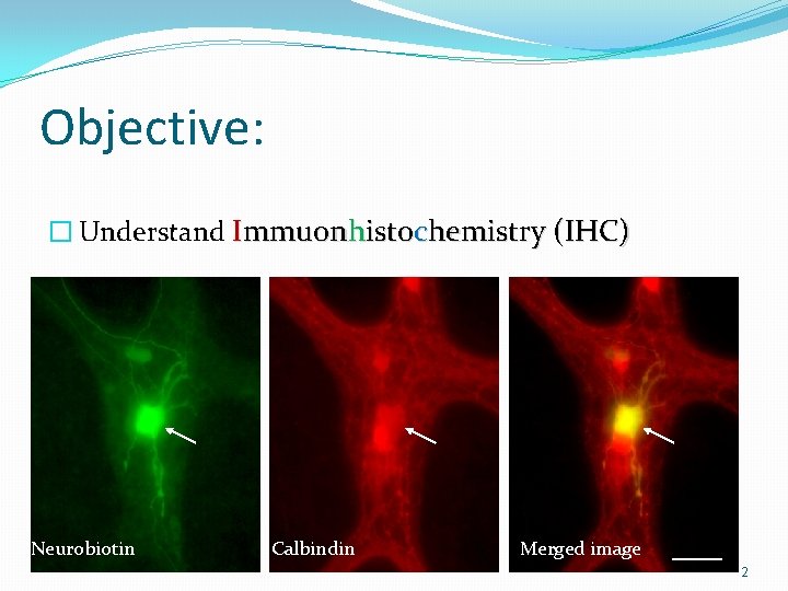 Objective: � Understand Immuonhistochemistry (IHC) Neurobiotin Calbindin Merged image 2 