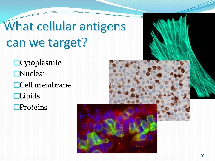 What cellular antigens can we target? �Cytoplasmic �Nuclear �Cell membrane �Lipids �Proteins 30 