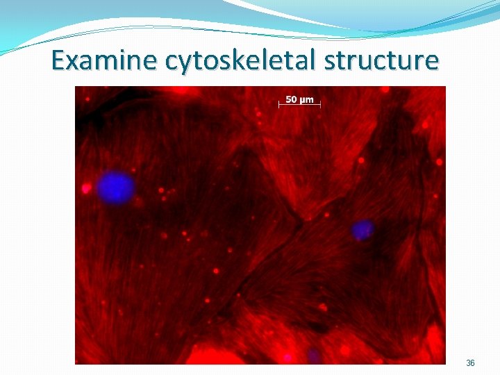 Examine cytoskeletal structure 36 