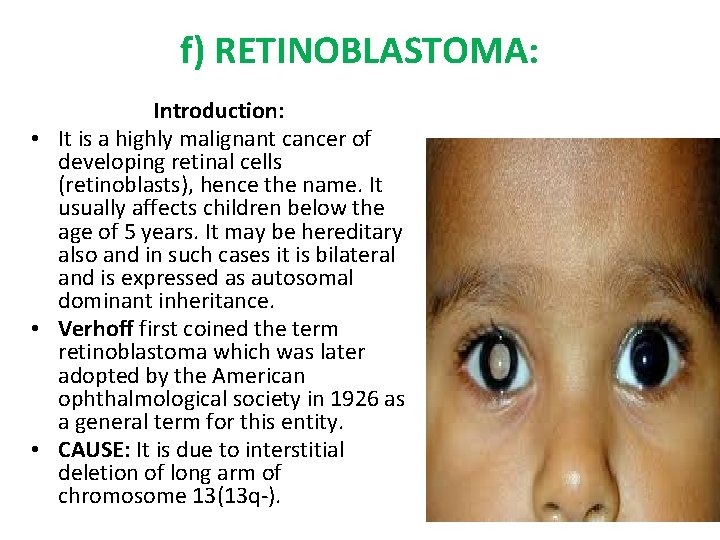 f) RETINOBLASTOMA: Introduction: • It is a highly malignant cancer of developing retinal cells