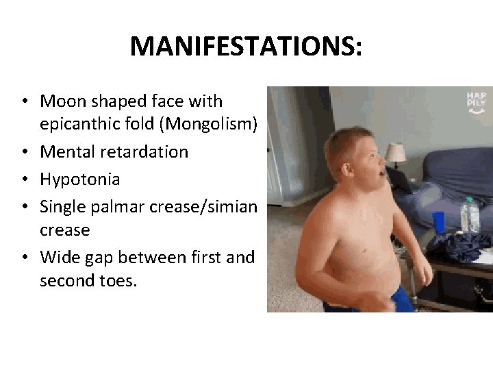 MANIFESTATIONS: • Moon shaped face with epicanthic fold (Mongolism) • Mental retardation • Hypotonia