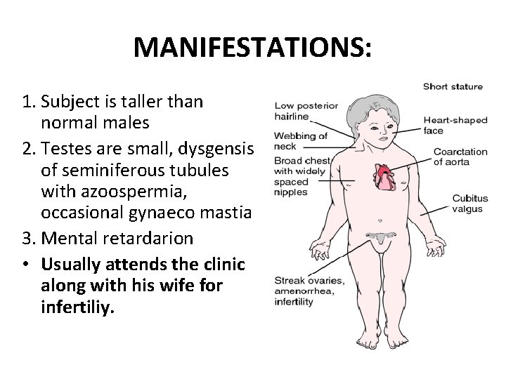 MANIFESTATIONS: 1. Subject is taller than normal males 2. Testes are small, dysgensis of