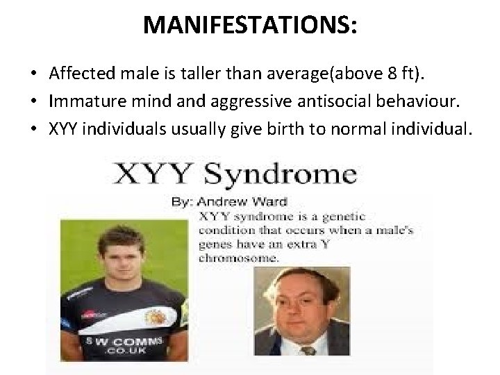 MANIFESTATIONS: • Affected male is taller than average(above 8 ft). • Immature mind aggressive