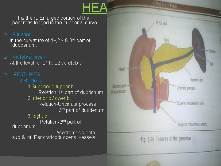 HEAD It is the rt. Enlarged portion of the pancreas lodged in the duodenal