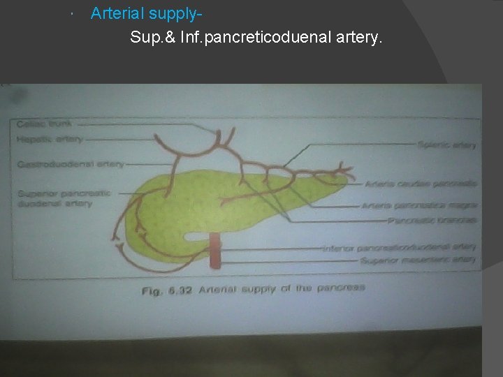  Arterial supply. Sup. & Inf. pancreticoduenal artery. 