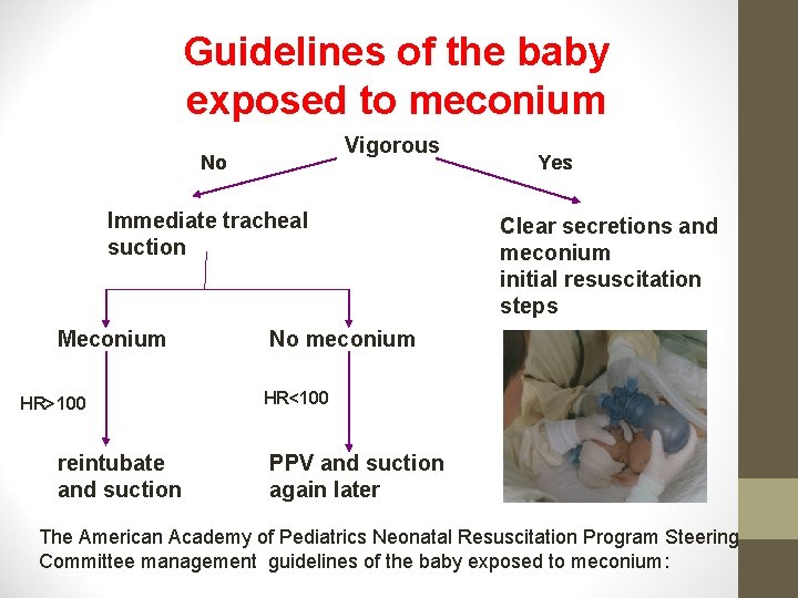 Guidelines of the baby exposed to meconium Vigorous No Immediate tracheal suction Meconium HR>100