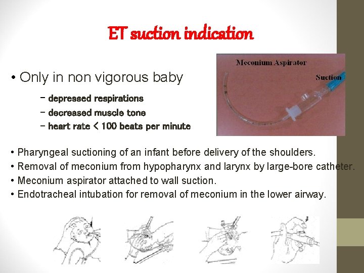 ET suction indication • Only in non vigorous baby - depressed respirations - decreased