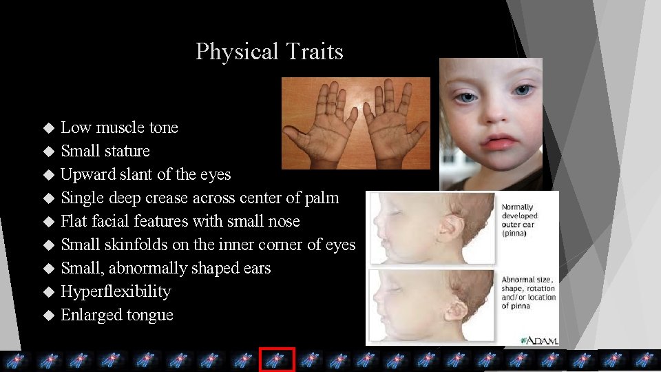 Physical Traits Low muscle tone Small stature Upward slant of the eyes Single deep Physical Traits Low muscle tone Small stature Upward slant of the eyes Single deep
