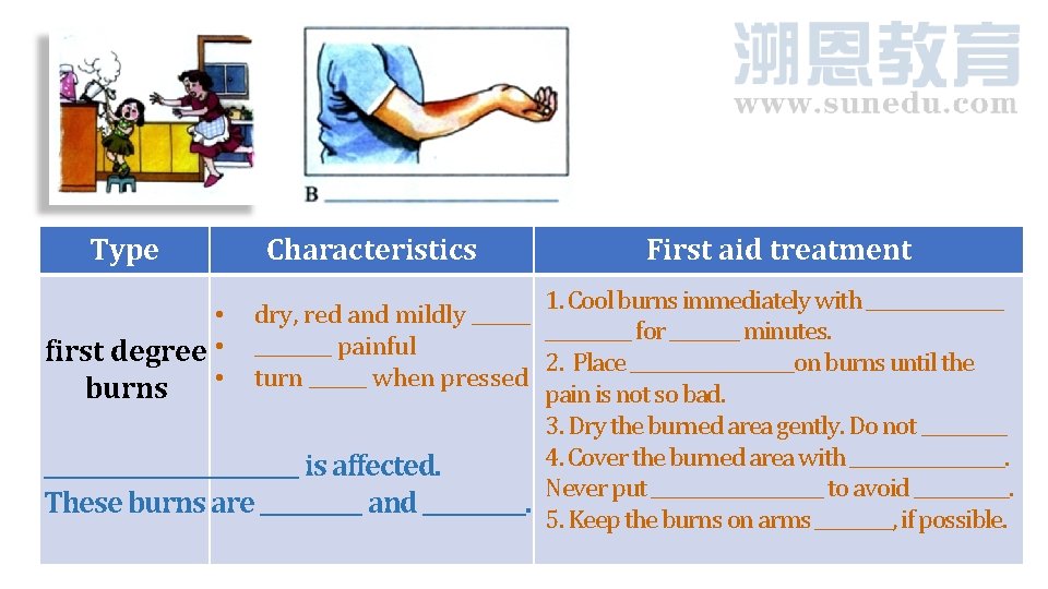 Type Characteristics First aid treatment 1. Cool burns immediately with ________ • dry, red