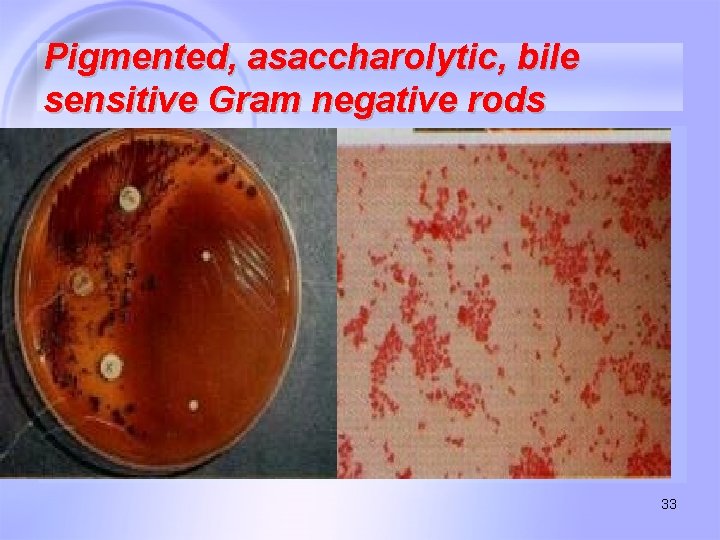 Pigmented, asaccharolytic, bile sensitive Gram negative rods 33 