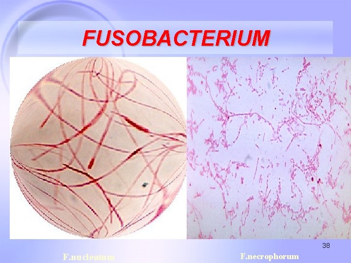 FUSOBACTERIUM 38 F. nucleatum F. necrophorum 