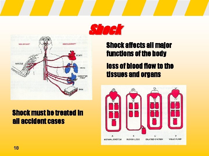 Shock affects all major functions of the body loss of blood flow to the