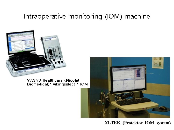 Intraoperative monitoring (IOM) machine 