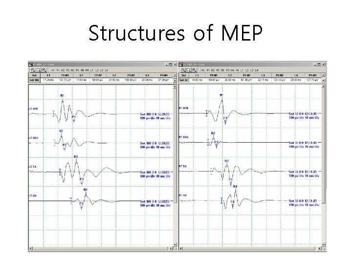 Structures of MEP 