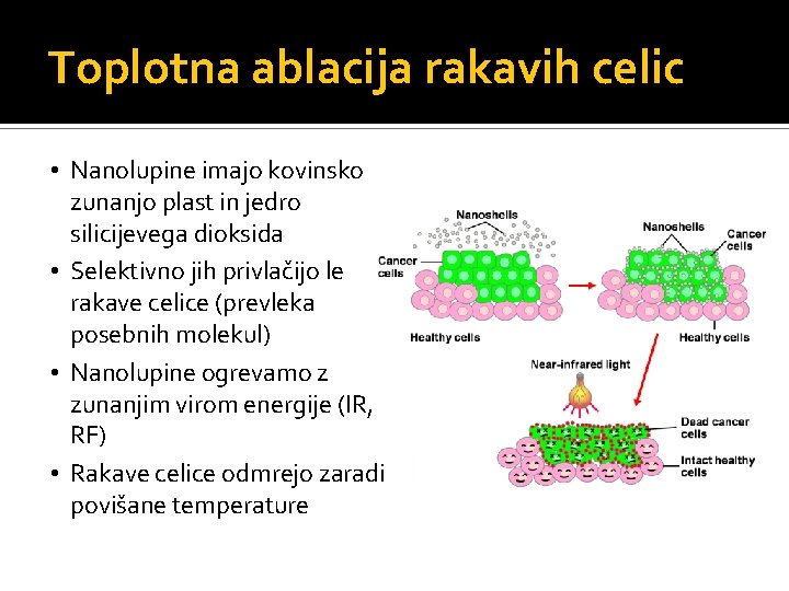 Toplotna ablacija rakavih celic • Nanolupine imajo kovinsko zunanjo plast in jedro silicijevega dioksida