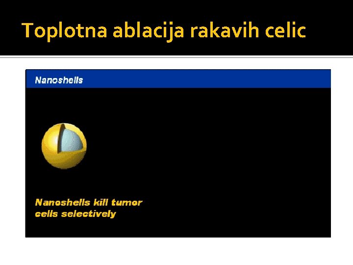 Toplotna ablacija rakavih celic 