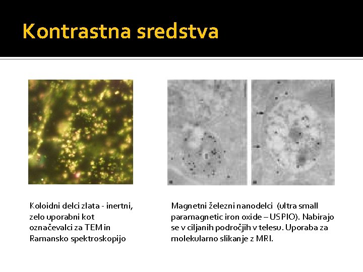 Kontrastna sredstva Koloidni delci zlata - inertni, zelo uporabni kot označevalci za TEM in