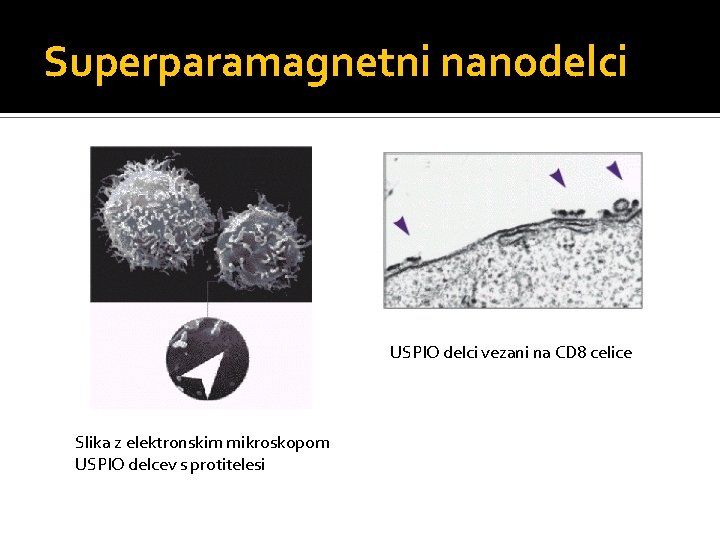 Superparamagnetni nanodelci USPIO delci vezani na CD 8 celice Slika z elektronskim mikroskopom USPIO