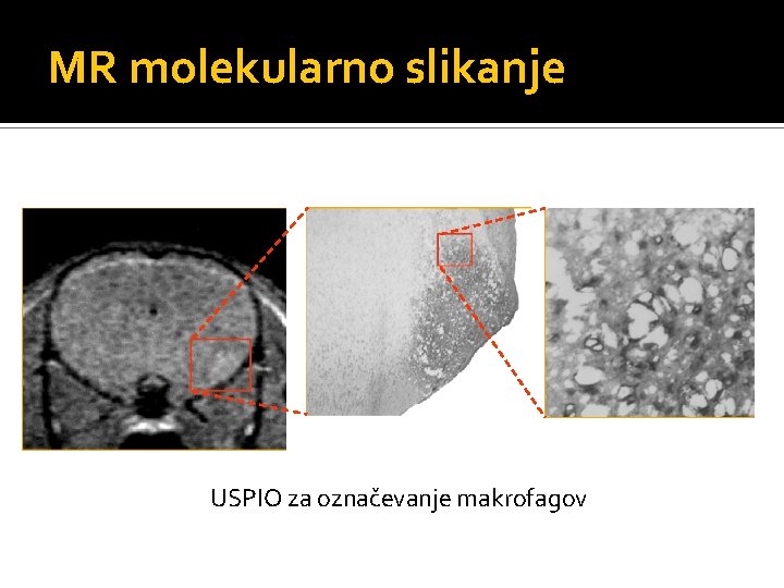 MR molekularno slikanje USPIO za označevanje makrofagov 