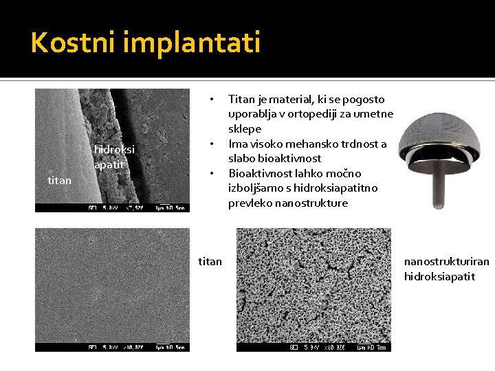 Kostni implantati • hidroksi apatit titan • • titan Titan je material, ki se