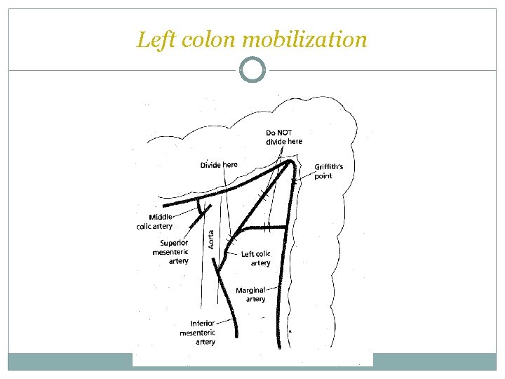 Left colon mobilization  Left colon mobilization