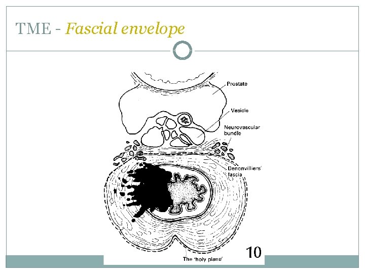 TME - Fascial envelope  TME - Fascial envelope