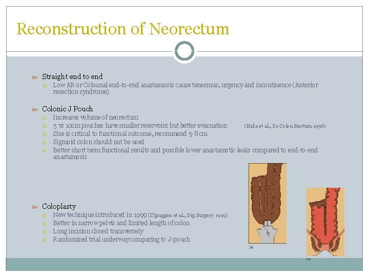 Reconstruction of Neorectum Straight end to end Low AR or Coloanal end-to-end anastamosis cause Reconstruction of Neorectum Straight end to end Low AR or Coloanal end-to-end anastamosis cause
