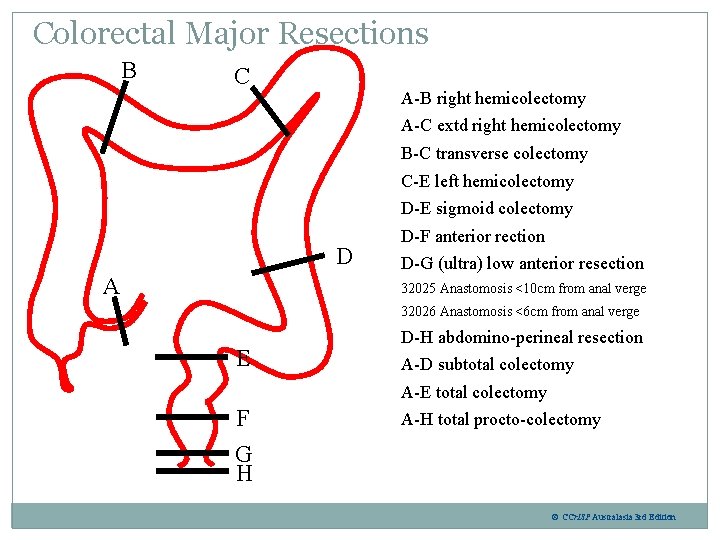 Colorectal Major Resections B C A-B right hemicolectomy A-C extd right hemicolectomy B-C transverse Colorectal Major Resections B C A-B right hemicolectomy A-C extd right hemicolectomy B-C transverse
